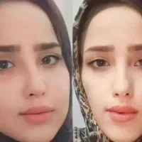 جوانه گندم|آرایشی، بهداشتی، درمانی|تهران, تهرانسر غربی|دیوار
