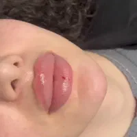 اموزش خدمات ژل بوتاکس مزوتراپی پلکسرهمراه مدرک|خدمات آموزشی|مشهد, آزادشهر|دیوار