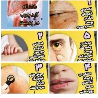 پاکسازی کبد چرب تضمینی|خدمات آرایشگری و زیبایی|گرگان, |دیوار