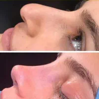 دکتر رستمی عمل زیبایی