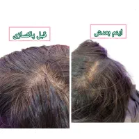 اسکراب اسکالپ ،کراتین ،فردائم