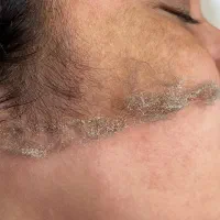 پاکسازی پوست