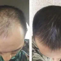 حال خوب. با رو.یش و مو