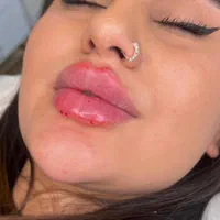تخفیف ویژه ژل و بوتاکس و آموزش