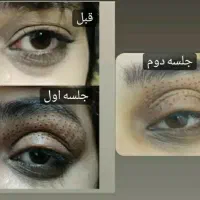 خدمات حرفه ای پلکسر(پلاسماجت) واکستنشن