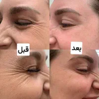 کرم ضد لک وچرک بیوممتیک