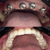 دندانپزشکی، ایمپلنت،کامپوزیت،ارتودنسی اقساط و چکی