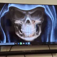 مینی کیس دل core i5 رم ۱۰ در حد|رایانه رومیزی|تهران, شهران جنوبی|دیوار