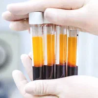 PRP پی آر پی مو و صورت