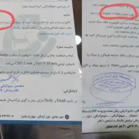 کبد چرب، تناسب اندام ،