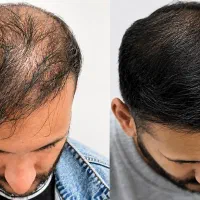 مثل آب خوردن موهاتو دربیار|ماهی|اصفهان, شاهزاده ابراهیم|دیوار
