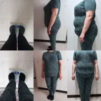 بمب چربی سوزی و بدون رژیم سخت