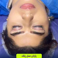 جشنوار بلفاروپلاستی-غبغب-بوکال فت-سانترال لب|خدمات آرایشگری و زیبایی|تهران, پاسداران|دیوار