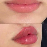 آف ژل وبوتاکس|خدمات آرایشگری و زیبایی|مسجد سلیمان, |دیوار