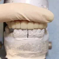 پودر گذار قالب ریز سنگ فریم زن