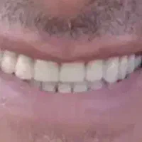 ت خفیف ویژه در طرح به زیبایی لبخند|آرایشی، بهداشتی، درمانی|یزد, |دیوار