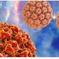 درمان زگیل تناسلی(Hpv) بصورت سنتی