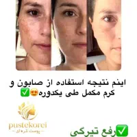 نزدیک عید شده میخوای بدرخشی