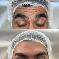 جشنواره بادی/فیلرصورت/ژل لب /جوانساز/ درگلشهر|خدمات زیبایی و سلامت|کرج, گلشهر|دیوار