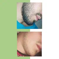 تضمینی مثل این قبل و بعد ها شو