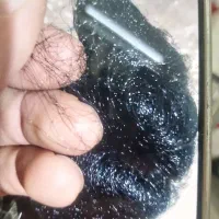 تور نگه داری سهره با پایه