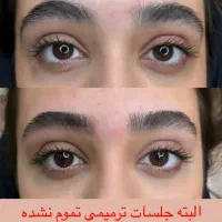 اجاره لاین کراتین ومژه واپیلاسیون وتاتوبدن