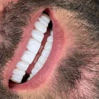 جشنواره پاییزه کامپوزیت فقط 1/500|خدمات آرایشگری و زیبایی|شیراز, تندگویان|دیوار