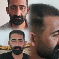 کاشت مو ،ریش و ابرو|خدمات زیبایی و سلامت|شیراز, عفیفآباد|دیوار