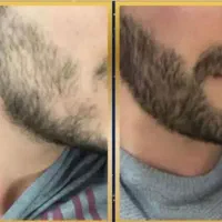 با چسب ریش رویش ریش به چهره ات هدیه بده