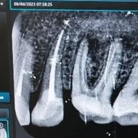 جشنواره دندانپزشکی دکتر یگانه میدان سرقنات|خدمات آرایشگری و زیبایی|قدس, شهرقدس|دیوار