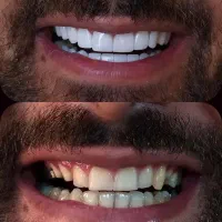 آموزش دندانپزشکی