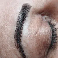 مدل میکروبلیدینگ(فیبروز) برای آلبوم کاری