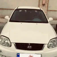 هیوندا ورنا سفید مدل ۸۵ دنده‌ای دوررنگ