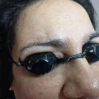 پاک کردن تاتوبالیزرکیوسوییچ|خدمات آرایشگری و زیبایی|مشهد, گلشور|دیوار