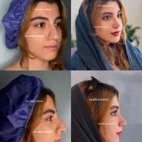 جراحی زیبایی بینی با متخصص گوش ، حلق و بینی