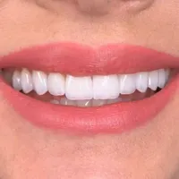 ونیر کامپوزیت لبه شیشه ای|خدمات آرایشگری و زیبایی|ارومیه, |دیوار