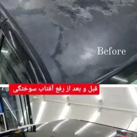 رفع آفتاب سوختگی