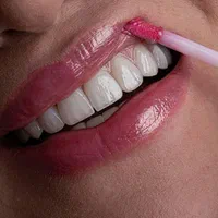کامپوزیت دندان دندانپزشکی لمینت روکش ایمپلنت|خدمات آرایشگری و زیبایی|تهران, فردوس|دیوار
