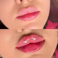 انجام کلیه خدمات درمانی در منزل شما