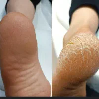 کفسابی پدیکور ناخن اپیلاسیون درایثارگران عبادی