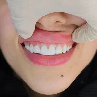 دندانپزشکی|خدمات آرایشگری و زیبایی|ارومیه, |دیوار