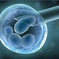 تخمک اهدایی