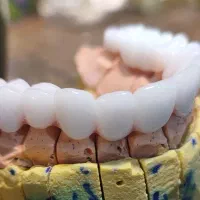 لابراتوار دندانسازی (روکش ثابت)|پزشکی|کرمانشاه, |دیوار