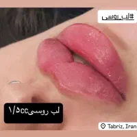 جشنواره تزریق فیلر،بوتاکس ،نخ،لاغری و هایفو|خدمات آرایشگری و زیبایی|تبریز, |دیوار