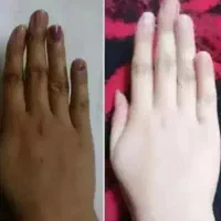 فرمول سفیدی تضمینی
