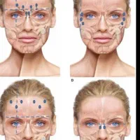 خدمات آموزش ژل بوتاکس مزوتراپی پرسینگ