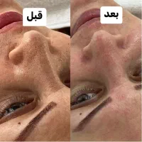 فیشیال پاکسازی