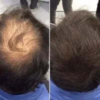 عمیق بازسازی کن
