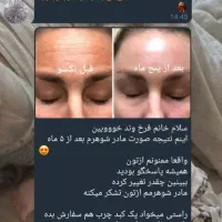 پوست ومووزیبایی ولاغری