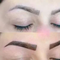 حذف انواع تاتو و خالکوبی با کیوسوئیچ|خدمات آرایشگری و زیبایی|برازجان, |دیوار